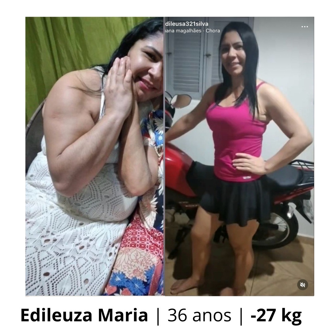 Edileuza Maria — transformação antes e depois, perdeu 27 kg