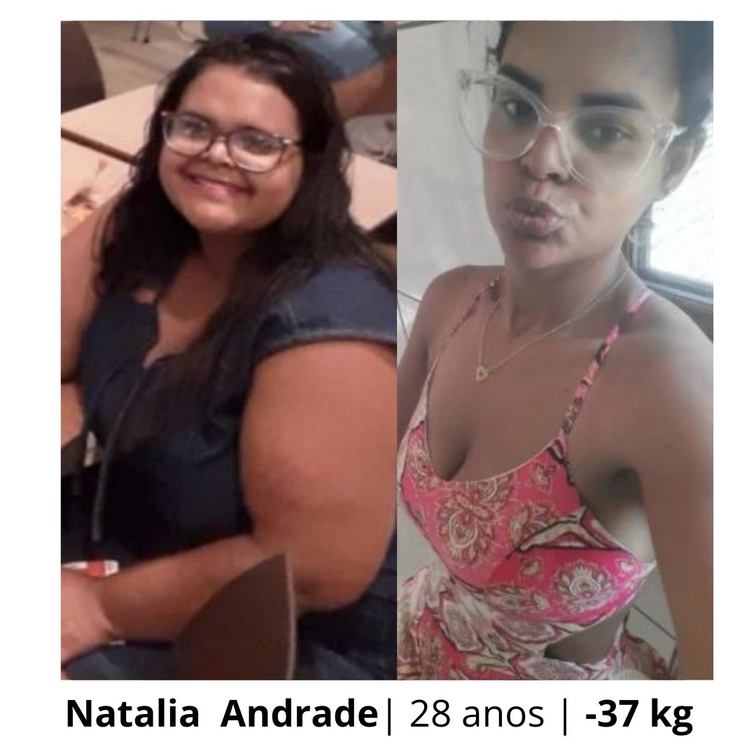 Natalia Andrade — transformação antes e depois, perdeu 37 kg